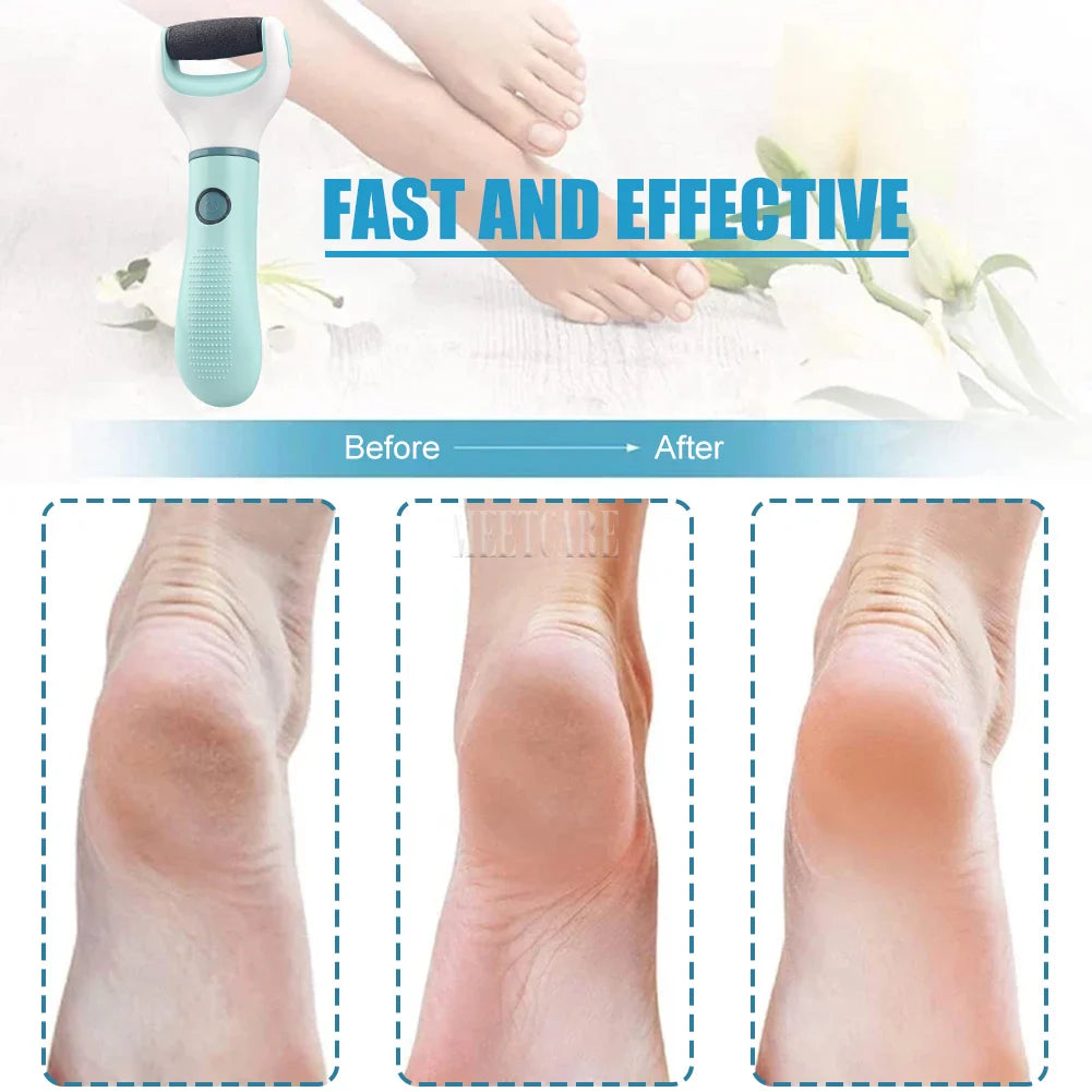 Electric Foot Grinder Auto Wireless Remove Dead Skin Calluses Cracks Hard Cracked skin Pedicure Tool Waterproof Foot Cleaner